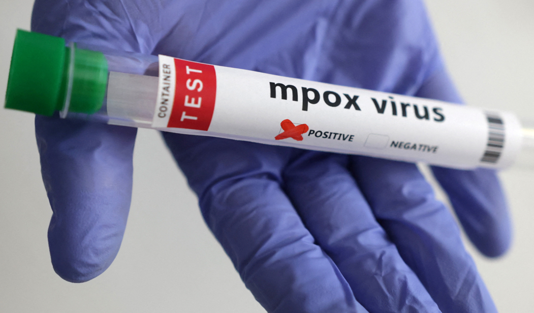 France identifies first case of new mpox variant, AFP reports